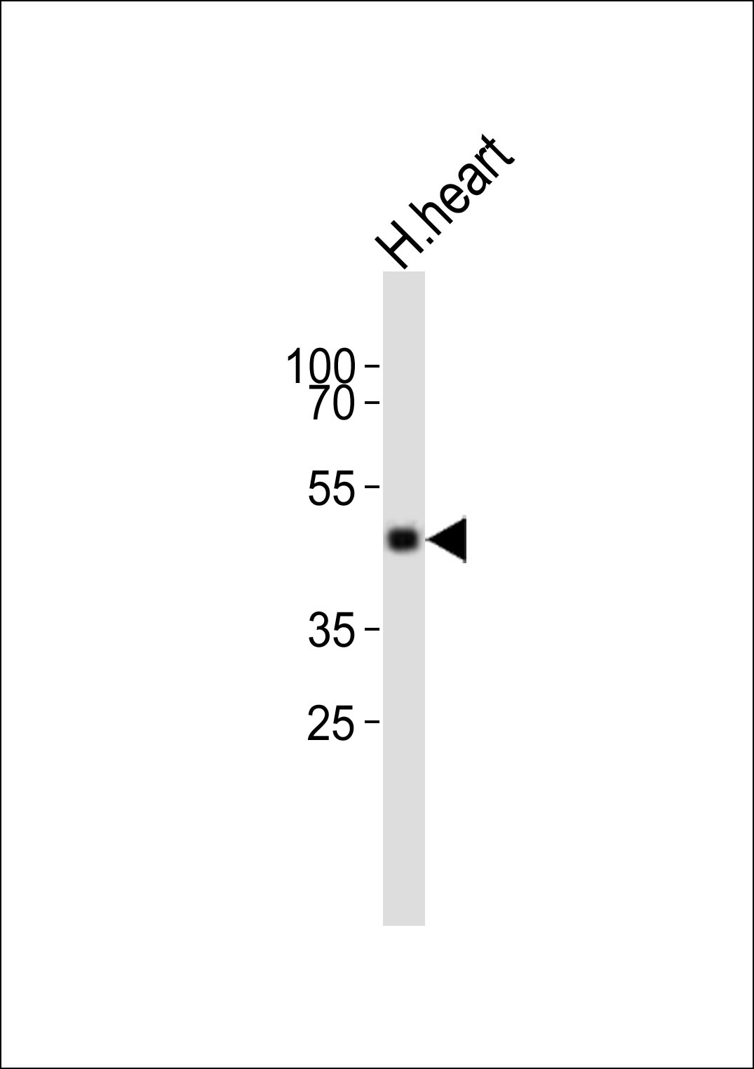 Western blot analysis of lysate from human heart tissue lysate,  using TIMM50 Antibody (N-term)(Cat.  #AP20709a).  AP20709a was diluted at 1:1000.  A goat anti-rabbit IgG H&L(HRP) at 1:10000 dilution was used as the secondary antibody. Lysate at 20ug.