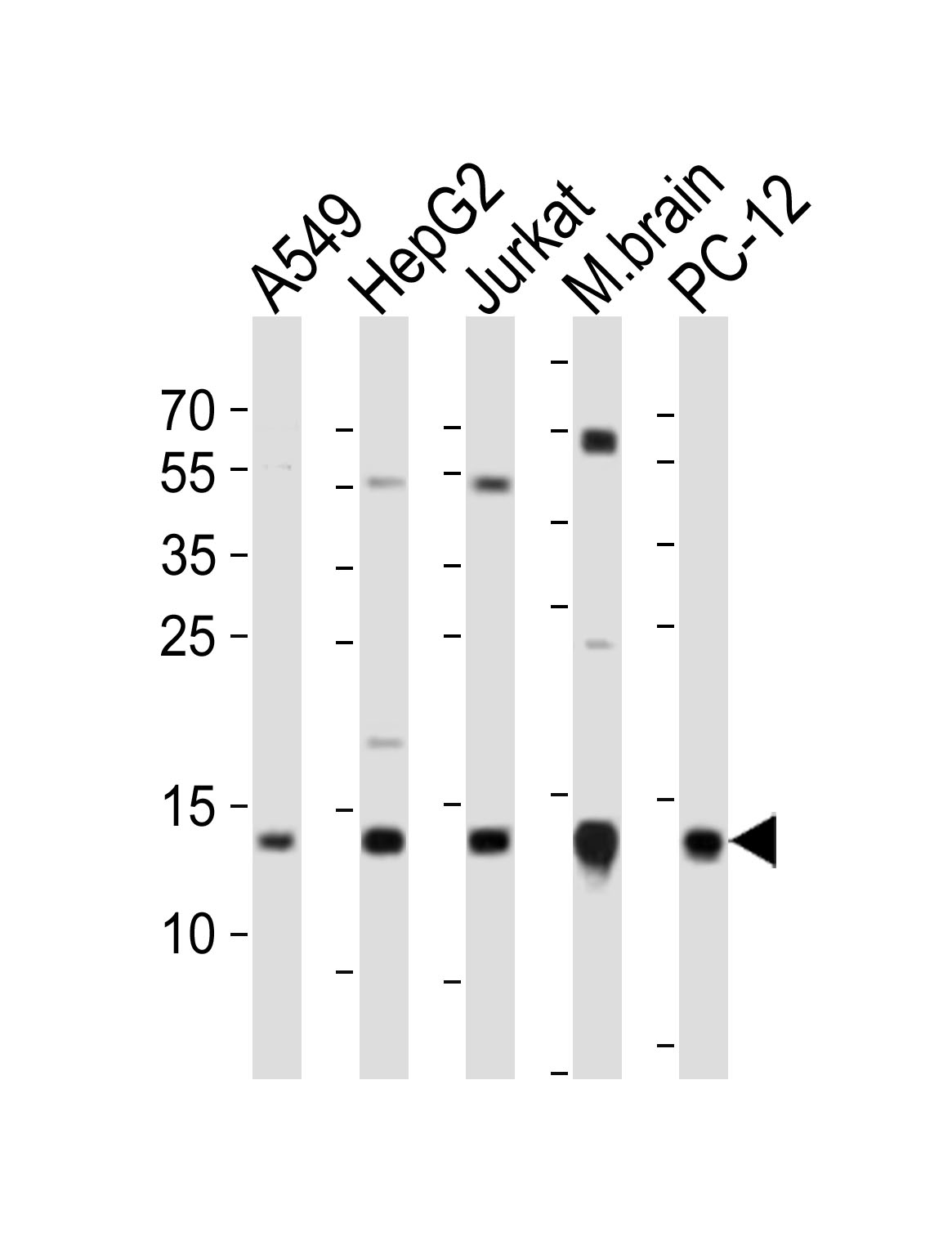 Western blot analysis of lysates from A549, HepG2, Jurkat cell line, mouse brain tissue lysate, rat PC-12 cell line (from left to right),  using ATP5D Antibody (C-term)(Cat.  #AP20890c).  AP20890c was diluted at 1:1000 at each lane.  A goat anti-rabbit IgG H&L(HRP) at 1:10000 dilution was used as the secondary antibody. Lysates at 20ug per lane.
