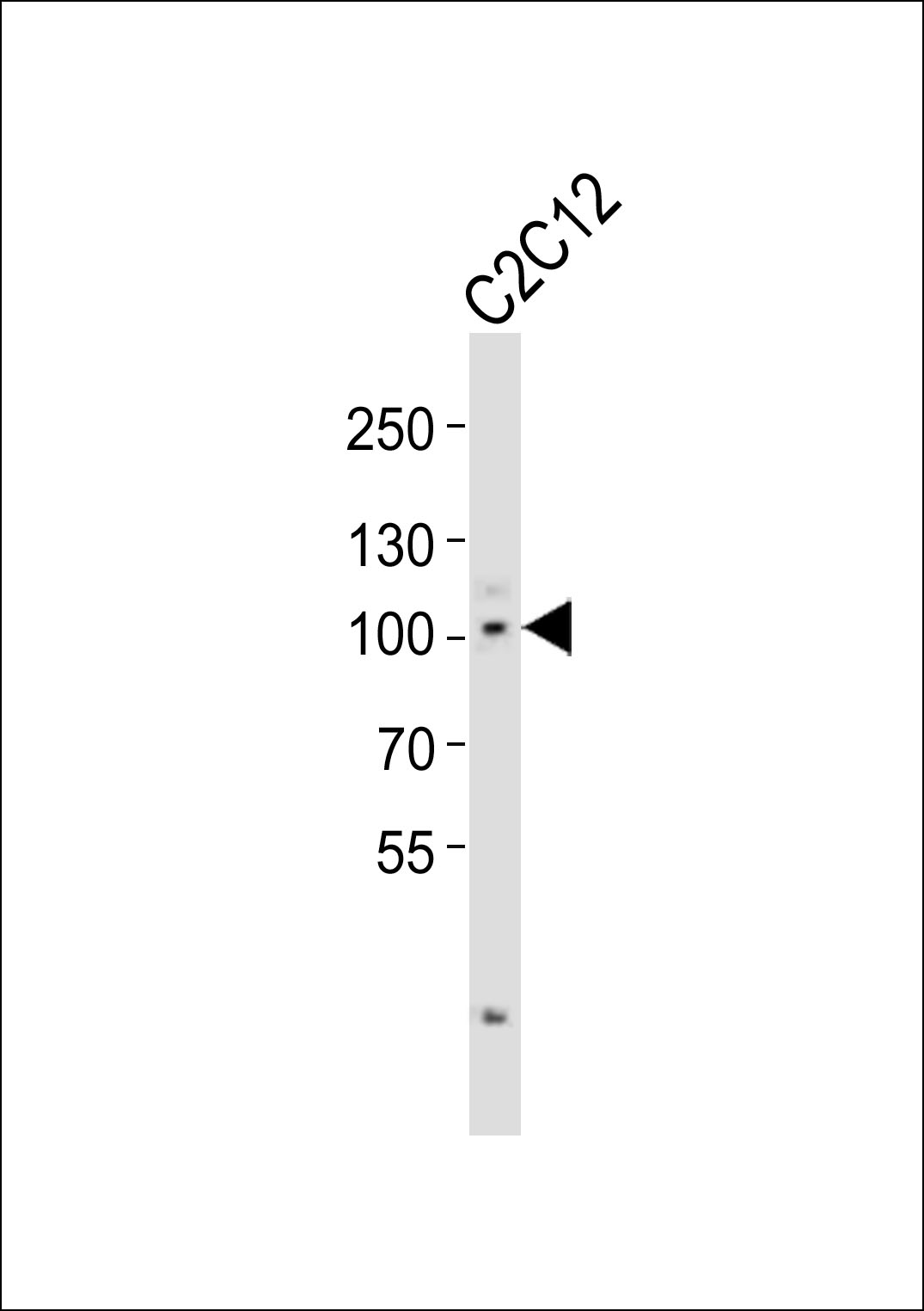WB - Mouse Myocd Antibody (C-term) AP20988c