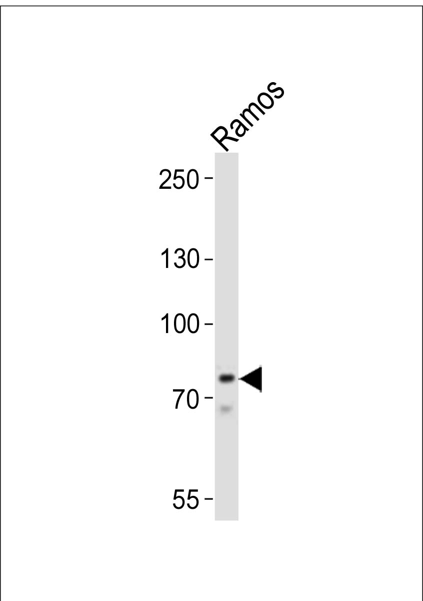 Western blot analysis of lysate from Ramos cell line,  using BTK Antibody (Center)(Cat.  #AP20992a).  AP20992a was diluted at 1:1000.  A goat anti-rabbit IgG H&L(HRP) at 1:10000 dilution was used as the secondary antibody. Lysate at 20ug.