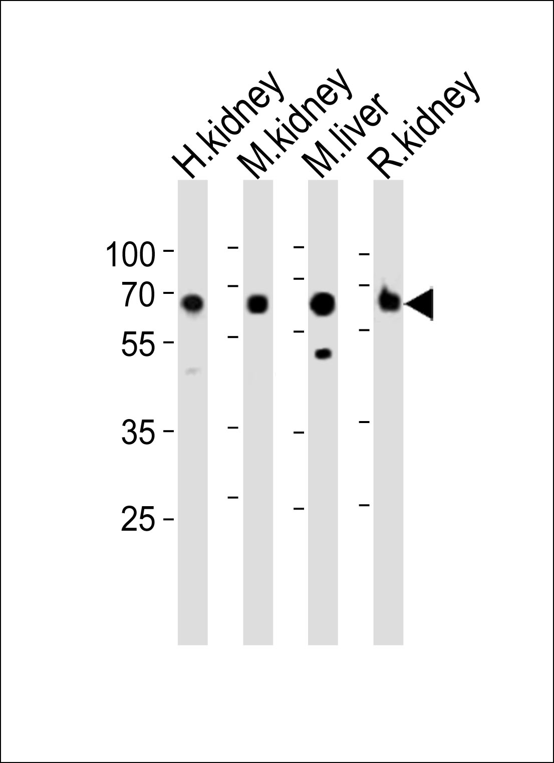 Western blot analysis of lysates from human kidney, mouse kidney,  mouse liver, rat kidney tissue lysate (from left to right), using ACSM5 Antibody (C-term)(Cat.     #AP21000c). AP21000c was diluted at 1:1000 at each lane.     A goat anti-rabbit IgG H&L(HRP) at 1:10000 dilution was used as the secondary antibody.    Lysates at 20ug per lane.