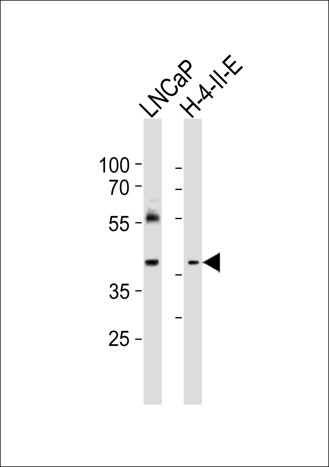 Western blot analysis of lysates from LNCaP, rat H-4-II-E cell line (from left to right),  using RING1 Antibody (C-term)(Cat.  #AP21001c).  AP21001c was diluted at 1:1000 at each lane.  A goat anti-rabbit IgG H&L(HRP) at 1:10000 dilution was used as the secondary antibody. Lysates at 20ug per lane.