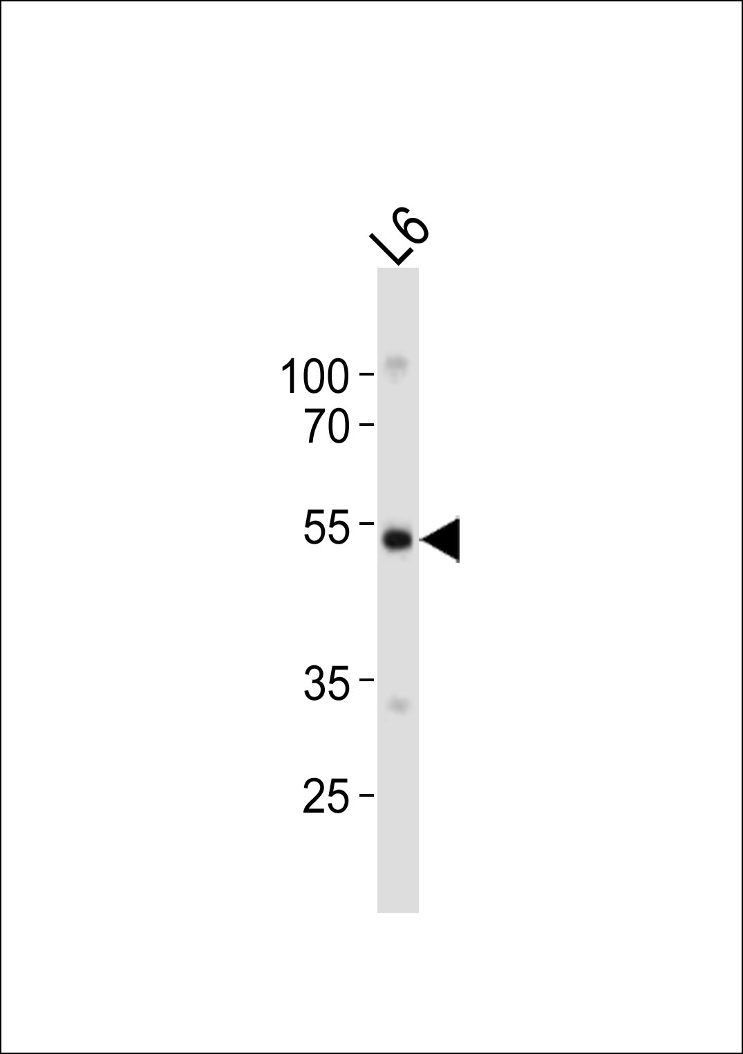 Western blot analysis of lysate from rat L6 cell line,  using Fgr Antibody (Center)(Cat.  #AP21017a).  AP21017a was diluted at 1:1000.  A goat anti-rabbit IgG H&L(HRP) at 1:10000 dilution was used as the secondary antibody. Lysate at 20ug.