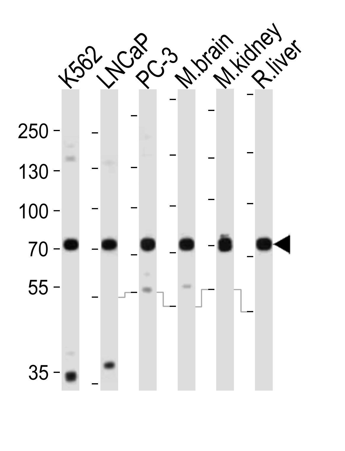 Western blot analysis of lysates from K562, LNCaP, PC-3 cell line, mouse brain, mouse kidney, rat liver tissue lysate (from left to right),  using CD164 Antibody (C-term)(Cat.  #AP21047a).  AP21047a was diluted at 1:1000 at each lane.  A goat anti-rabbit IgG H&L(HRP) at 1:10000 dilution was used as the secondary antibody. Lysates at 20ug per lane.