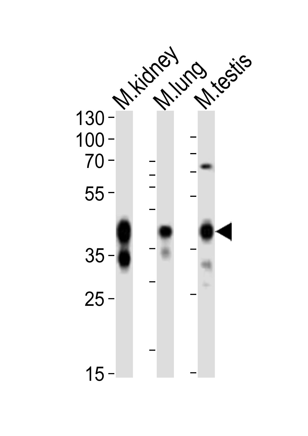 Western blot analysis of lysates from mouse kidney, mouse lung, mouse testis tissue lysate (from left to right),  using Epcam Antibody (C-term)(Cat.  #AP21054a).  AP21054a was diluted at 1:1000 at each lane.  A goat anti-rabbit IgG H&L(HRP) at 1:10000 dilution was used as the secondary antibody. Lysates at 20ug per lane.