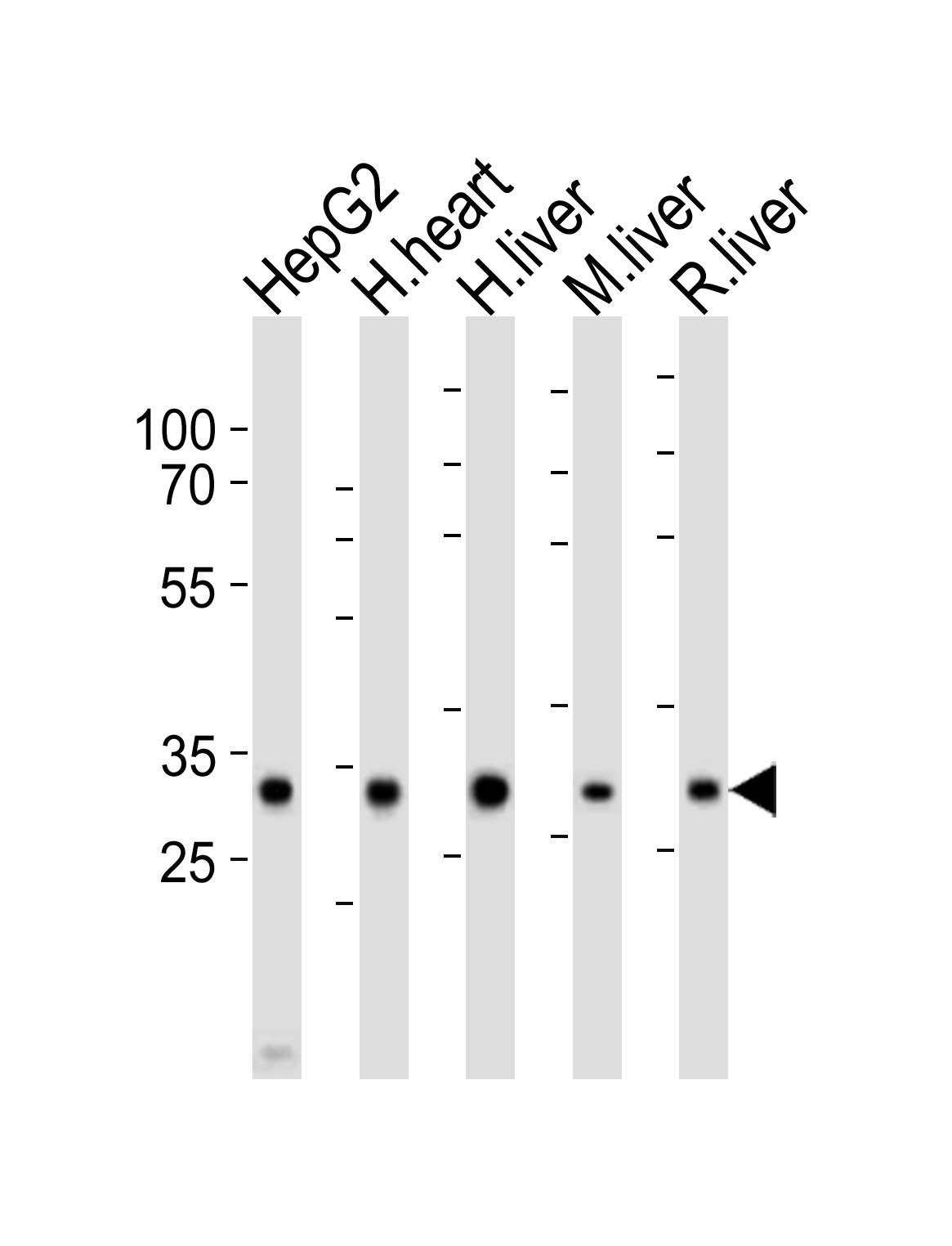 Western blot analysis of lysates from HepG2 cell line, human heart, human liver, mouse liver, rat liver tissue lysate (from left to right),  using DECR1 Antibody (Center)(Cat.  #AP21057a).  AP21057a was diluted at 1:1000 at each lane.  A goat anti-rabbit IgG H&L(HRP) at 1:10000 dilution was used as the secondary antibody. Lysates at 20ug per lane.