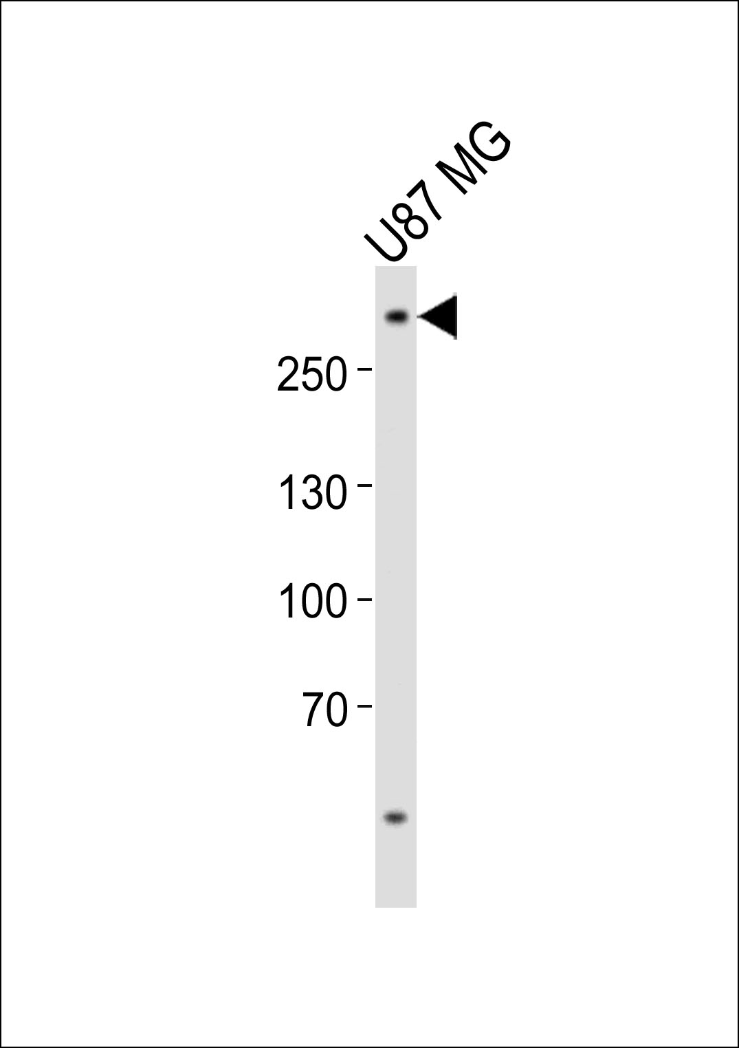 Western blot analysis of lysate from U-87 MG cell line,  using ABCA2 Antibody (Center)(Cat.  #AP21066a).  AP21066a was diluted at 1:1000.  A goat anti-rabbit IgG H&L(HRP) at 1:10000 dilution was used as the secondary antibody. Lysate at 20ug.