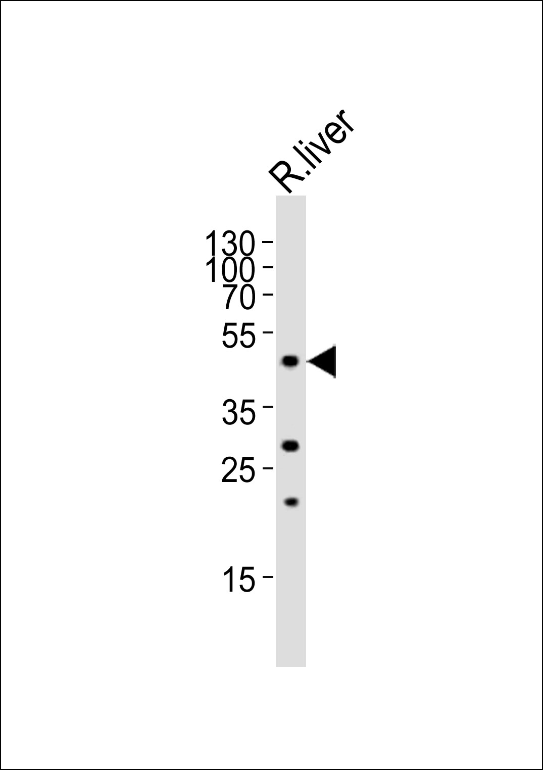 Western blot analysis of lysate from rat liver tissue,  using FOXA2 Antibody (C-term)(Cat.  #AP21068a).  AP21068a was diluted at 1:1000.  A goat anti-rabbit IgG H&L(HRP) at 1:10000 dilution was used as the secondary antibody. Lysate at 20ug.