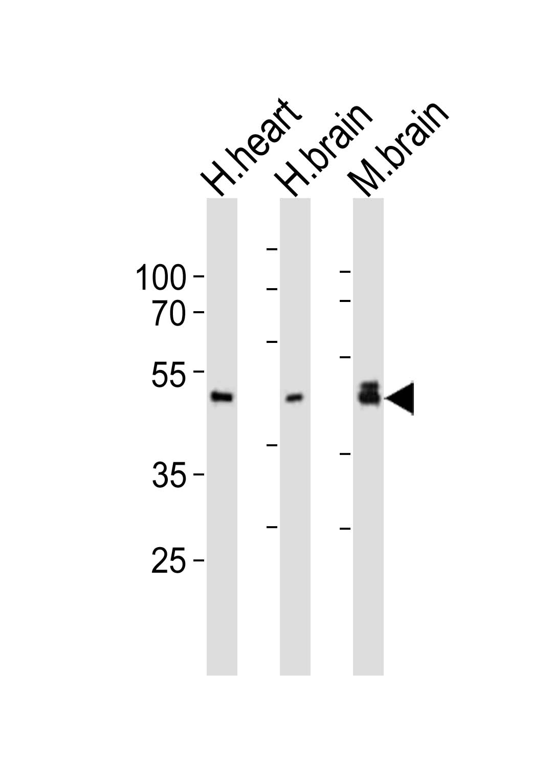 Western blot analysis of lysates from human heart, human brain, mouse brain tissue lysate (from left to right),  using NDEL1 Antibody (Center)(Cat.  #AP21101a).  AP21101a was diluted at 1:1000 at each lane.  A goat anti-rabbit IgG H&L(HRP) at 1:10000 dilution was used as the secondary antibody. Lysates at 20ug per lane.