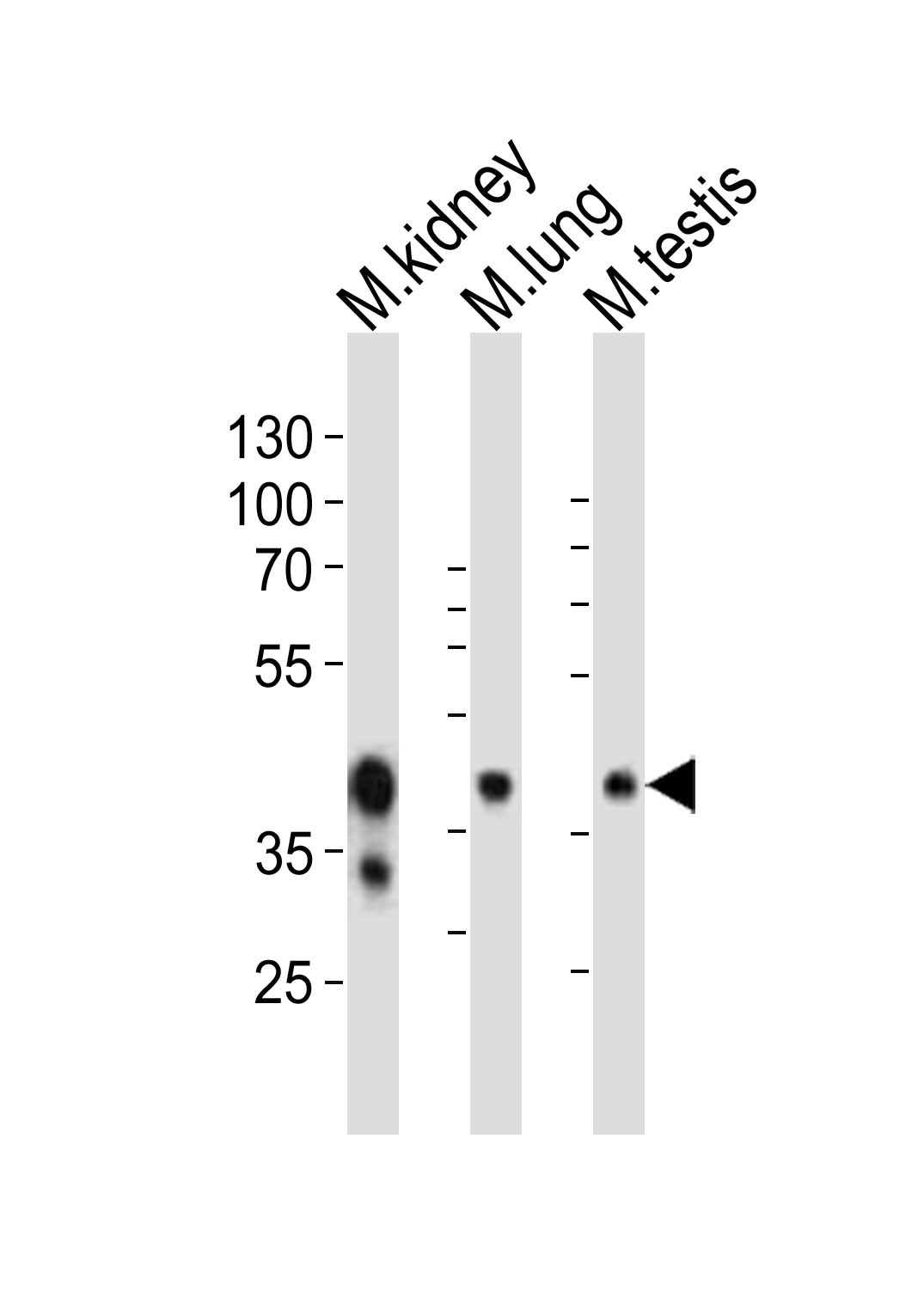 Western blot analysis of lysates from mouse kidney, mouse lung, mouse testis tissue lysate (from left to right),  using Epcam Antibody (C-term)(Cat.  #AP21114a).  AP21114a was diluted at 1:1000 at each lane.  A goat anti-rabbit IgG H&L(HRP) at 1:10000 dilution was used as the secondary antibody. Lysates at 20ug per lane.