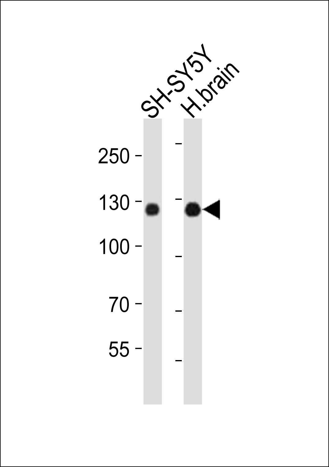 Western blot analysis of lysates from SH-SY5Y cell line, human brain tissue lysate(from left to right),  using AMPH Antibody (C-term)(Cat.  #AP21117a).  AP21117a was diluted at 1:1000 at each lane.  A goat anti-rabbit IgG H&L(HRP) at 1:10000 dilution was used as the secondary antibody. Lysates at 20ug per lane.