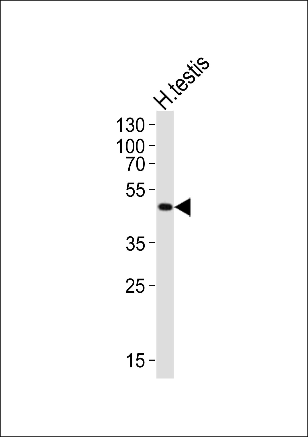 Western blot analysis of lysate from human testis tissue lysate,  using LIPI Antibody (Center)(Cat.  #AP21120a). AP21120a was diluted at 1:1000.  A goat anti-rabbit IgG H&L(HRP) at 1:10000 dilution was used as the secondary antibody. Lysate at 20ug.