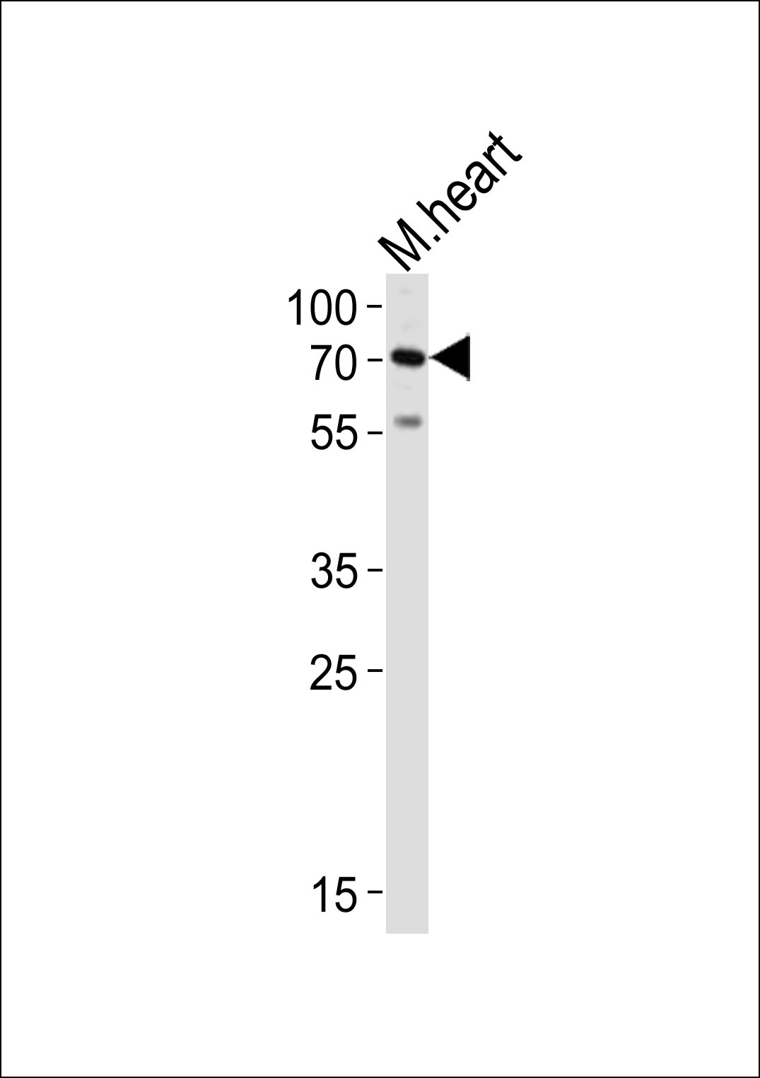 Western blot analysis of lysate from mouse heart tissue lysate,  using HAS2 Antibody (Center)(Cat.  #AP5687c). AP5687c was diluted at 1:1000.  A goat anti-rabbit IgG H&L(HRP) at 1:10000 dilution was used as the secondary antibody. Lysate at 20ug.