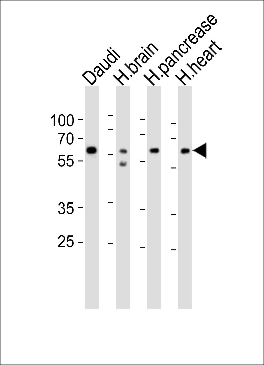 Western blot analysis of lysates from Daudi cell line, human brain, human pancrease, human heart tissue (from left to right),  using PACSIN1 Antibody (G23)(Cat.  #AP8087a).  AP8087a was diluted at 1:1000 at each lane.  A goat anti-rabbit IgG H&L(HRP) at 1:10000 dilution was used as the secondary antibody. Lysates at 20ug per lane.