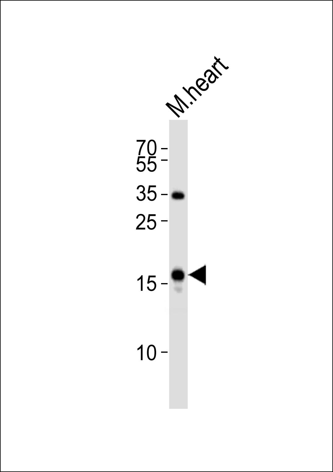 WB - NPPA Antibody (N-term) AP8534A