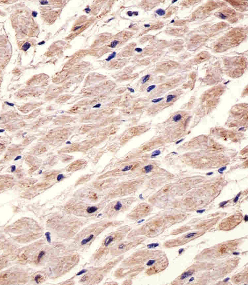 IHC-P - CHRM2 Antibody AM8445b