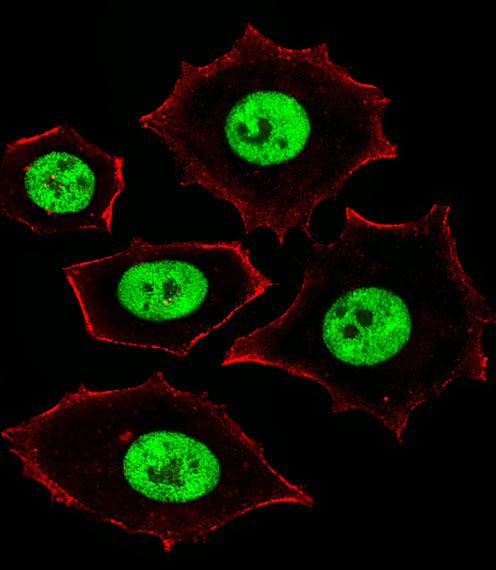 Fluorescent image of MCF-7 cells stained with ZNF434 Antibody (Center)(Cat#AP20442c). AP20442c was diluted at 1:25 dilution.  An Alexa Fluor 488-conjugated goat anti-rabbit lgG at 1:400 dilution was used as the secondary antibody (green).  Cytoplasmic actin was counterstained with Alexa Fluor� 555 conjugated with Phalloidin (red).