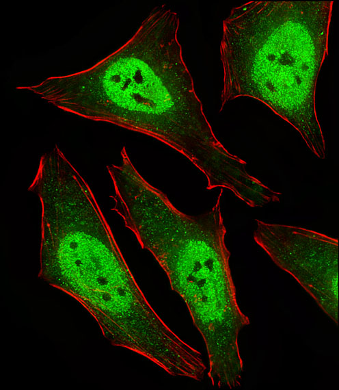 Fluorescent image of Hela cells stained with MAD2L2 Antibody (C-term)(Cat#AP20654c). AP20654c was diluted at 1:25 dilution.  An Alexa Fluor 488-conjugated goat anti-rabbit lgG at 1:400 dilution was used as the secondary antibody (green).  Cytoplasmic actin was counterstained with Alexa Fluor� 555 conjugated with Phalloidin (red).