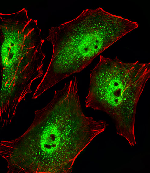 Fluorescent image of A549 cells stained with Mouse Sirt1 Antibody (C-term)(Cat#AP20849c). AP20849c was diluted at 1:25 dilution.  An Alexa Fluor 488-conjugated goat anti-rabbit lgG at 1:400 dilution was used as the secondary antibody (green).  Cytoplasmic actin was counterstained with Alexa Fluor� 555 conjugated with Phalloidin (red).