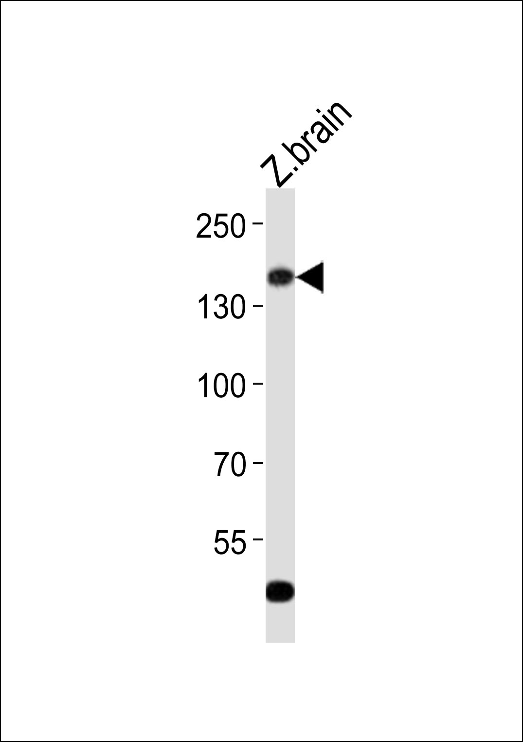 Western blot analysis of lysate from zebra fish brain tissue lysate,  using (DANRE) gpr126 Antibody (C-term)(Cat.  #AP21136a). AP21136a was diluted at 1:500.  A goat anti-rabbit IgG H&L(HRP) at 1:10000 dilution was used as the secondary antibody. Lysate at 20ug.