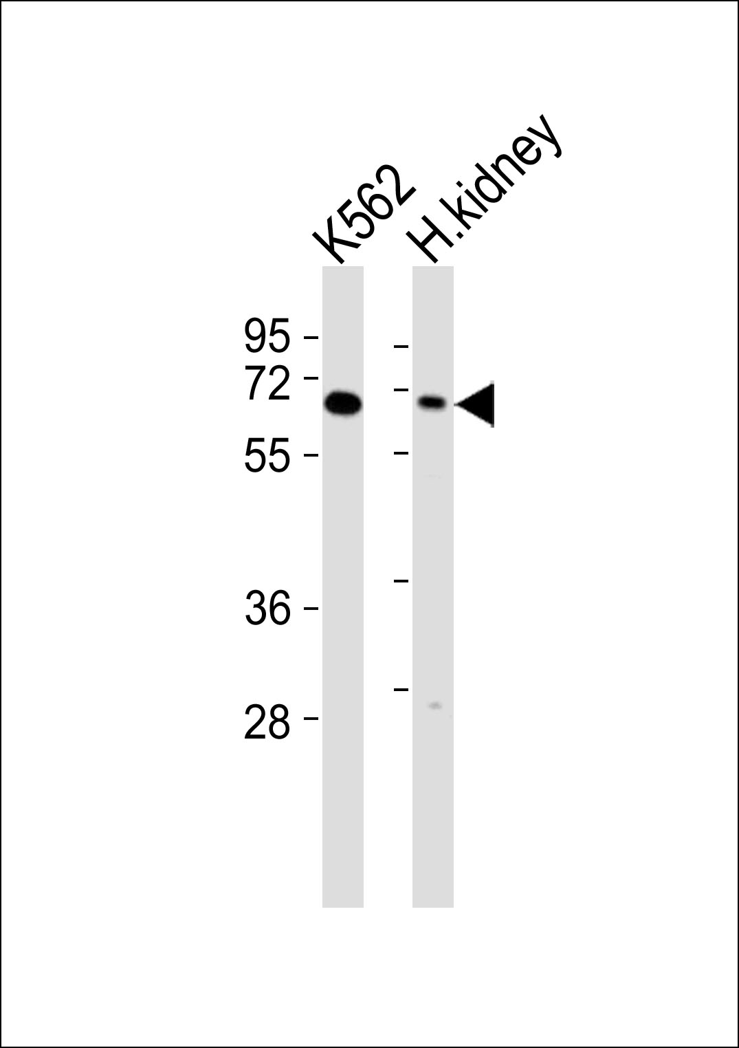 WB - Arylsulfatase D Antibody AP50999