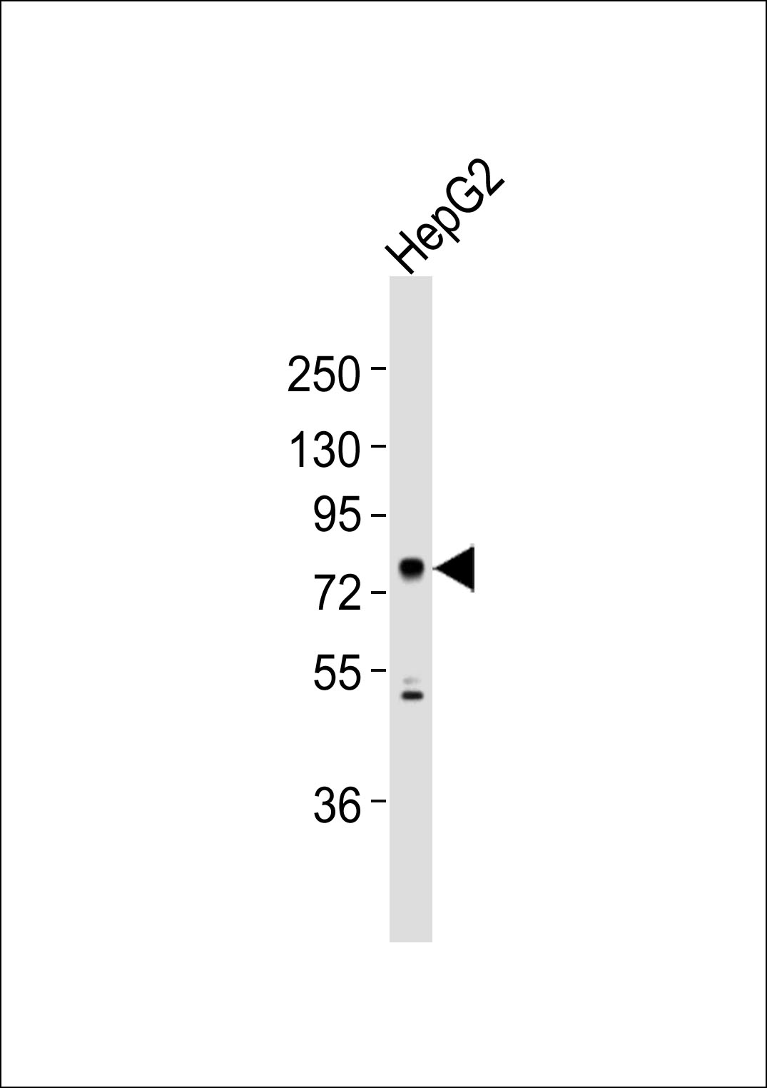 WB - CNGA2 Antibody AP51097