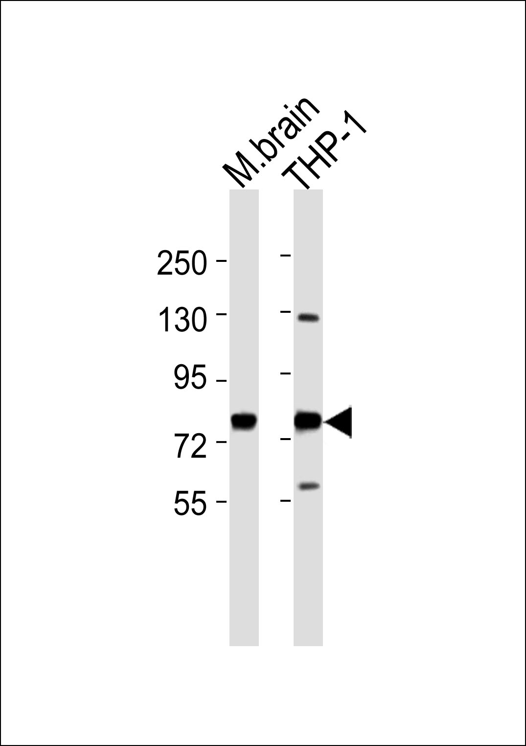 WB - GUCY1A3 Antibody AP51251