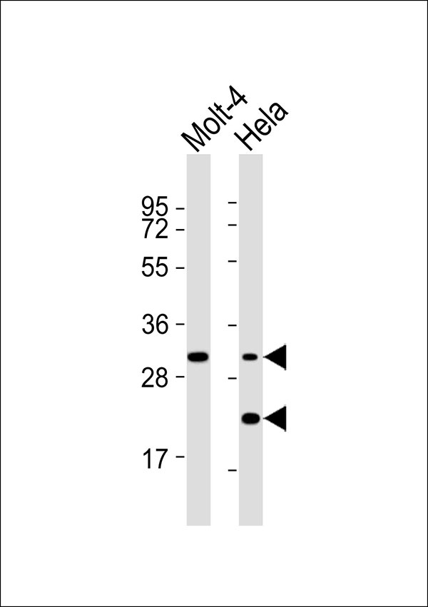 WB - SMUG1 Antibody AP51894