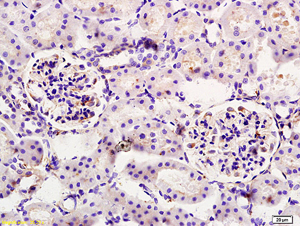 Rabbit Anti-CYP11A1 Polyclonal Antibody - Purified Rabbit Polyclonal