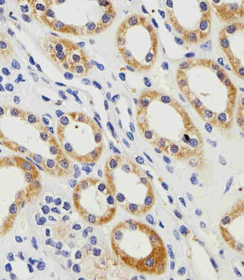 IHC-P - PGK1 Antibody (Center) AP7094b