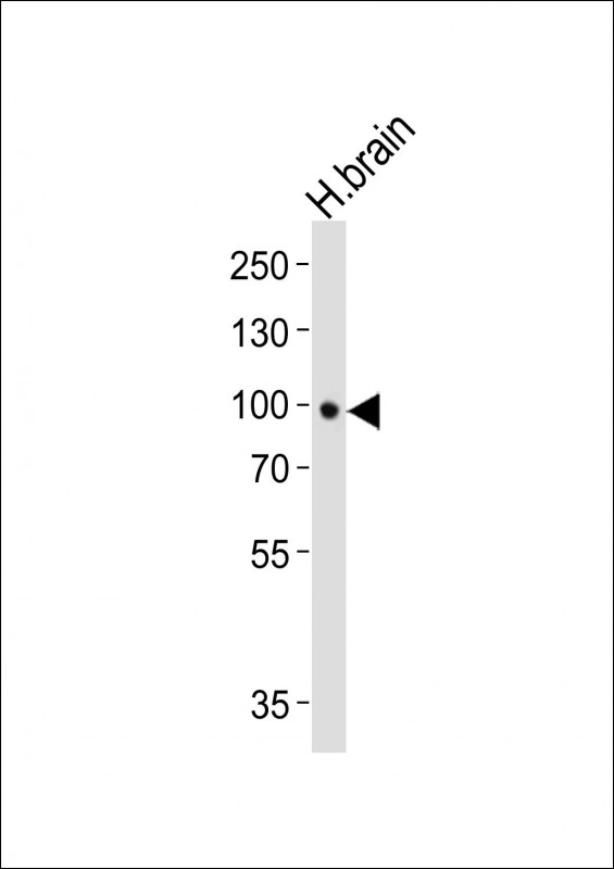Western blot analysis of lysate from human brain tissue lysate,  using NTRK2 Antibody(Cat.  #AM8457b). AM8457b was diluted at 1:1000.  A goat anti-mouse IgG H&L(HRP) at 1:10000 dilution was used as the secondary antibody. Lysate at 20?g.