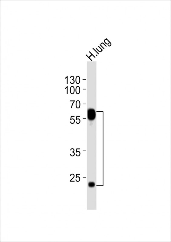Anti-FLT1 Antibody at  1:2000 dilution + human lung lysatesLysates/proteins at 20 ?g per lane.  SecondaryGoat Anti-mouse IgG,   (H+L),  Peroxidase conjugated at 1/10000 dilutionPredicted band size : 151 kDBlocking/Dilution buffer: 5% NFDM/TBST.