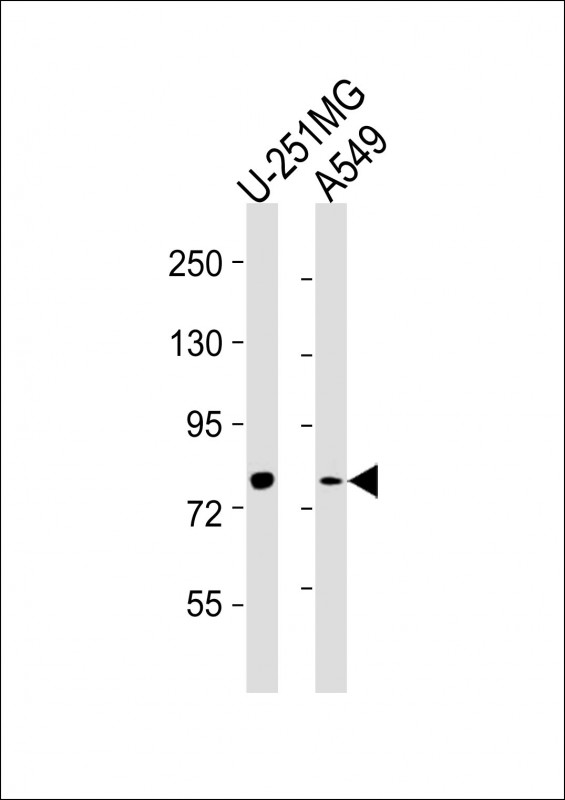 All lanes : Anti-FES Antibody at  1:2000 dilutionLane 1: U-251MG whole cell lysatesLane 2: A549 whole cell lysatesLysates/proteins at 20 ?g per lane. SecondaryGoat Anti-mouse IgG,  (H+L), Peroxidase conjugated at 1/10000 dilutionPredicted band size : 93 kDaBlocking/Dilution buffer: 5% NFDM/TBST.