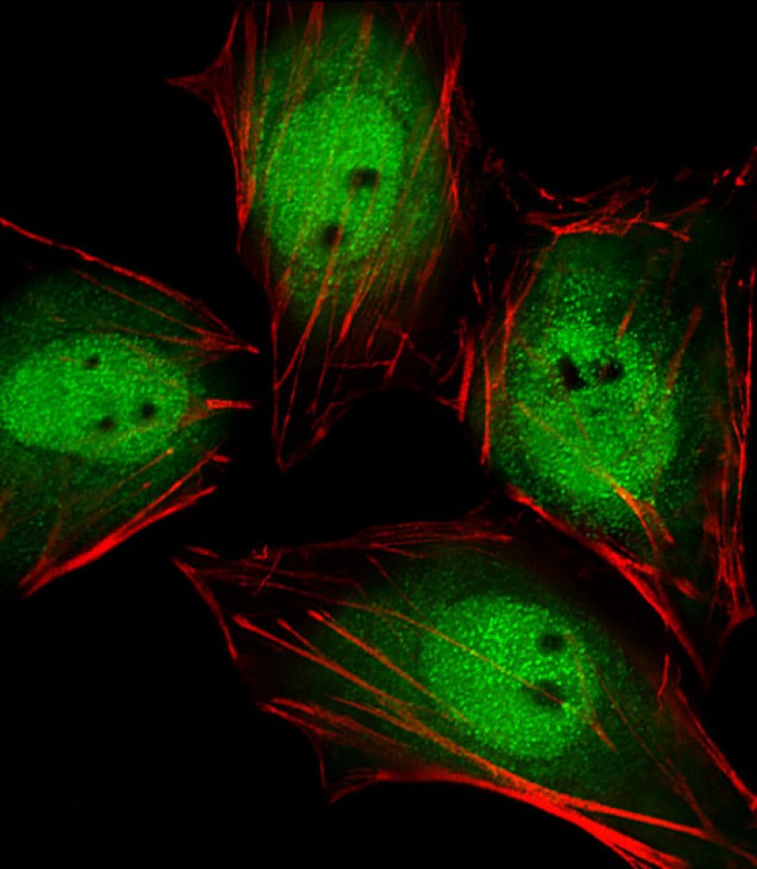 Fluorescent image of Hela cells stained with Mouse Actl6a Antibody (C-term)(Cat#AP20924c). AP20924c was diluted at 1:25 dilution.  An Alexa Fluor 488-conjugated goat anti-rabbit lgG at 1:400 dilution was used as the secondary antibody (green).  Cytoplasmic actin was counterstained with Alexa Fluor� 555 conjugated with Phalloidin (red).