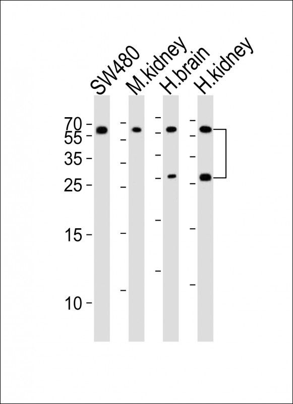 All lanes : Anti-FGF9 Antibody at  1:4000 dilutionLane 1: SW480 whole cell lysatesLane 2: mouse kidney lysatesLane 3: human brain lysatesLane 4: human kidney lysatesLysates/proteins at 20 �g per lane. SecondaryGoat Anti-Rabbit IgG,  (H+L), Peroxidase conjugated at 1/10000 dilutionPredicted band size : 23 kDaBlocking/Dilution buffer: 5% NFDM/TBST.