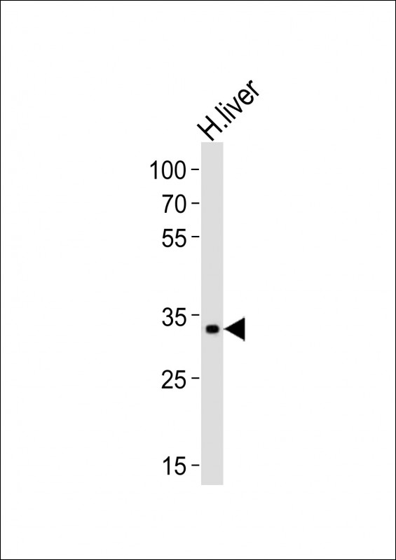 WB - LRTOMT Antibody (N-term) AP21148a