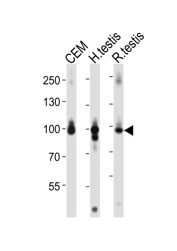 Western blot analysis of lysates from CEM cell line, human testis, rat testis tissue lysate (from left to right),  using ACAP2 Antibody (C-term)(Cat.  #AP21151a). A goat anti-rabbit IgG H&L(HRP) at 1:10000 dilution was used as the secondary antibody. Lysates at 20ug per lane.