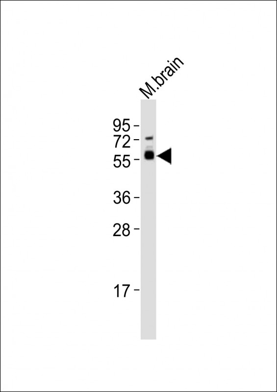 Anti-SMAD3 Antibody (Center) at 1:1000 dilution + mouse brain lysatesLysates/proteins at 20 �g per lane. SecondaryGoat Anti-Rabbit IgG,  (H+L), Peroxidase conjugated at 1/10000 dilutionPredicted band size : 48 kDaBlocking/Dilution buffer: 5% NFDM/TBST.