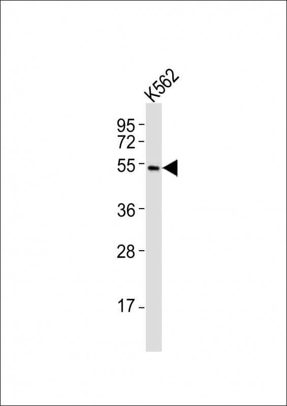 WB - (Mouse) Smarcd3 Antibody (Center) AP21168a