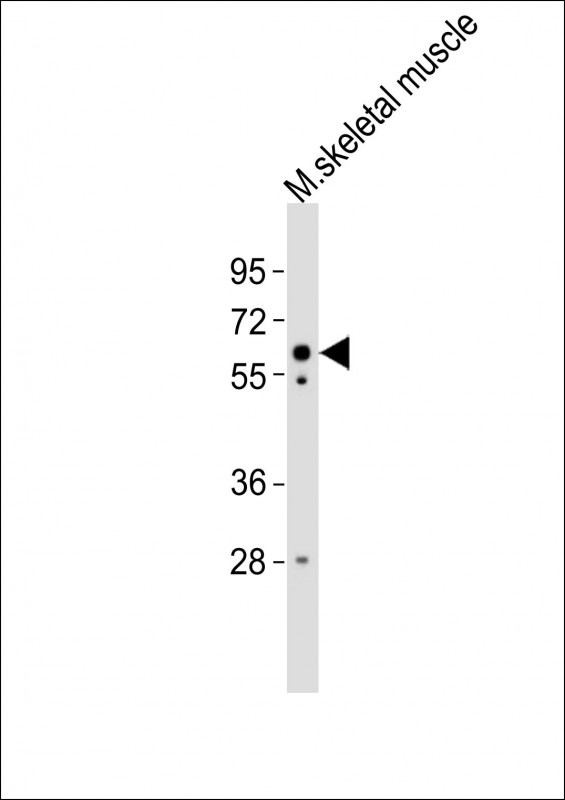 WB - (Mouse) Smarcd3 Antibody (Center) AP21168a