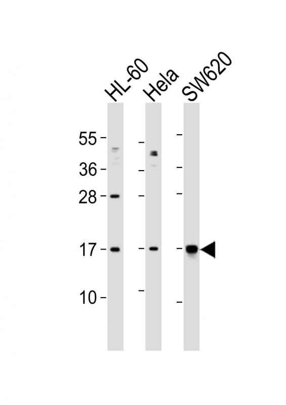 All lanes : Anti-UBE2N Antibody (Center) at 1:1000 dilutionLane 1: HL-60 whole cell lysatesLane 2: Hela whole cell lysatesLane 3: SW620 whole cell lysatesLysates/proteins at 20 �g per lane. SecondaryGoat Anti-Rabbit IgG,  (H+L), Peroxidase conjugated at 1/10000 dilutionPredicted band size : 17 kDaBlocking/Dilution buffer: 5% NFDM/TBST.