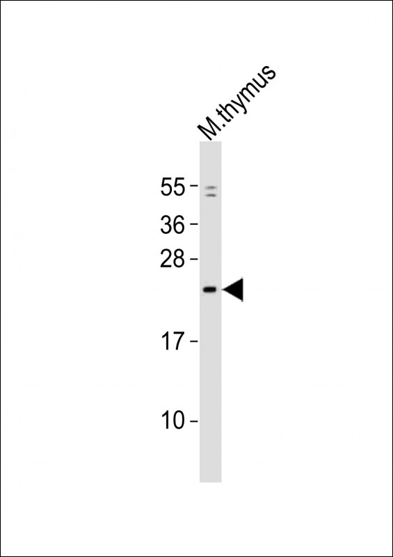 WB - Mouse Gins1 Antibody (C-term) AP21172a