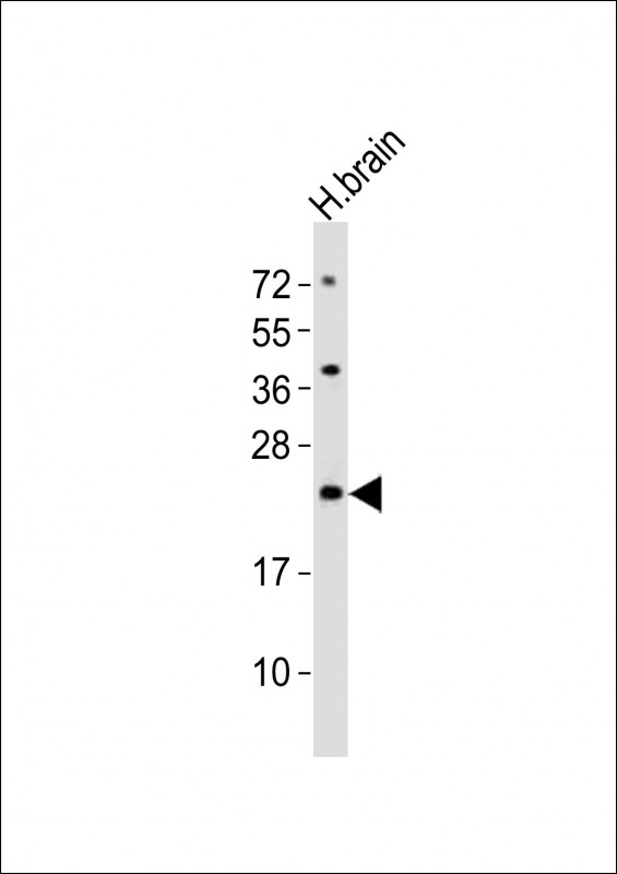 Anti-FAM168B Antibody (Center) at  1:2000 dilution + human brain lysatesLysates/proteins at 20 �g per lane. SecondaryGoat Anti-Rabbit IgG,  (H+L), Peroxidase conjugated at 1/10000 dilutionPredicted band size : 20 kDaBlocking/Dilution buffer: 5% NFDM/TBST.