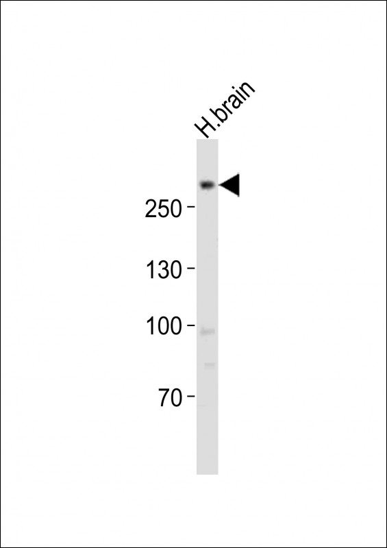 Anti-LRRK2 Antibody (C-term) at  1:1000 dilution + human brain lysatesLysates/proteins at 20 �g per lane. SecondaryGoat Anti-Rabbit IgG,  (H+L), Peroxidase conjugated at 1/10000 dilutionPredicted band size : 286 kDaBlocking/Dilution buffer: 5% NFDM/TBST.