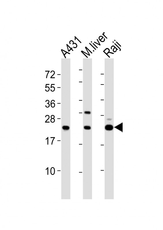 All lanes : Anti-PSMB9 Antibody (C-term) at  1:2000 dilutionLane 1: A431 whole cell lysatesLane 2: mouse liver lysatesLane 3: Raji whole cell lysatesLysates/proteins at 20 �g per lane. SecondaryGoat Anti-Rabbit IgG,  (H+L), Peroxidase conjugated at 1/10000 dilutionPredicted band size : 23 kDaBlocking/Dilution buffer: 5% NFDM/TBST.