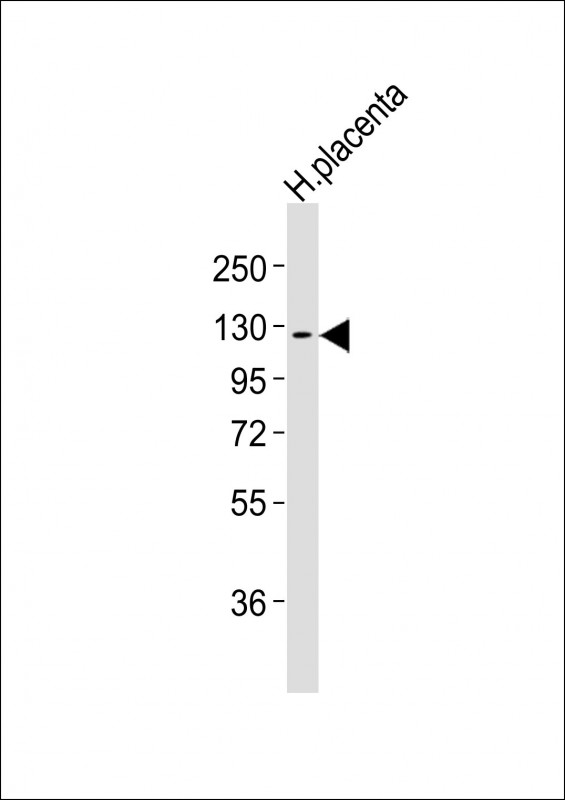 Anti-CSF1R Antibodyat  1:2000 dilution + human placenta lysatesLysates/proteins at 20 ?g per lane. SecondaryGoat Anti-mouse IgG,  (H+L), Peroxidase conjugated at 1/10000 dilutionPredicted band size : 108 kDaBlocking/Dilution buffer: 5% NFDM/TBST.