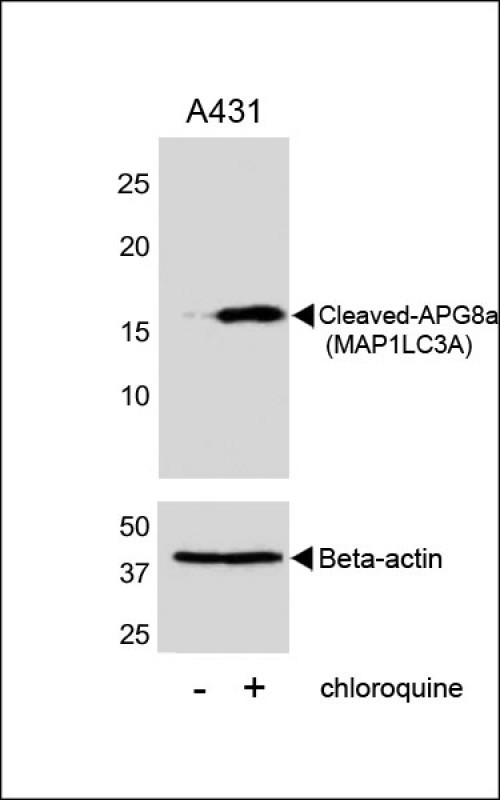 WB - Cleaved LC3A Antibody AP1805a