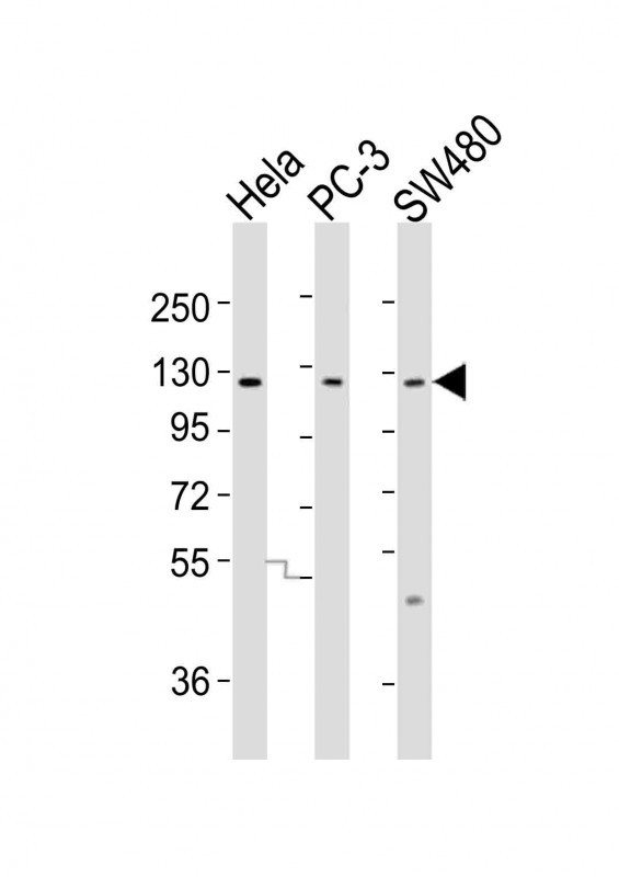 WB - SLCO1B3 Antibody (C-term) AP18964b