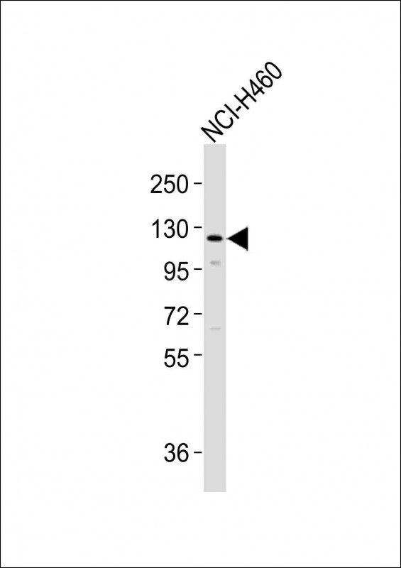 WB - SLCO1B3 Antibody (C-term) AP18964b