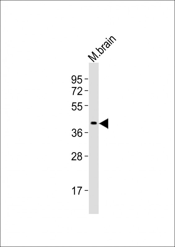 Anti-Rad9a Antibody (N-term) at 1:2000 dilution + M. brain tissue lysatesLysates/proteins at 20 �g per lane. SecondaryGoat Anti-Rabbit IgG,  (H+L), Peroxidase conjugated at 1/10000 dilutionPredicted band size : 42 kDaBlocking/Dilution buffer: 5% NFDM/TBST.